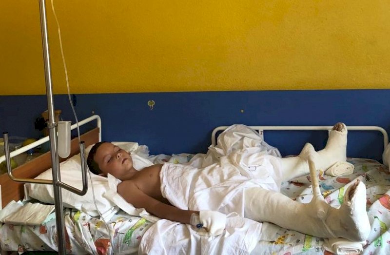 Мальчику-«лягушонку» из Екатеринбурга врачи заново собрали ноги.  «Цель – к школе научиться ходить» (ФОТО)