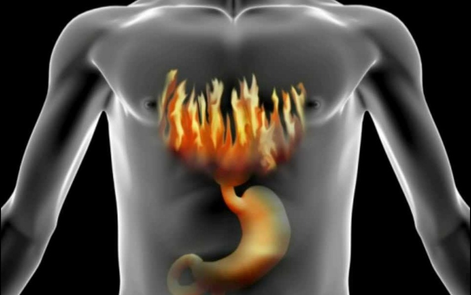 Синдром жжения в полости рта: как погасить пламя